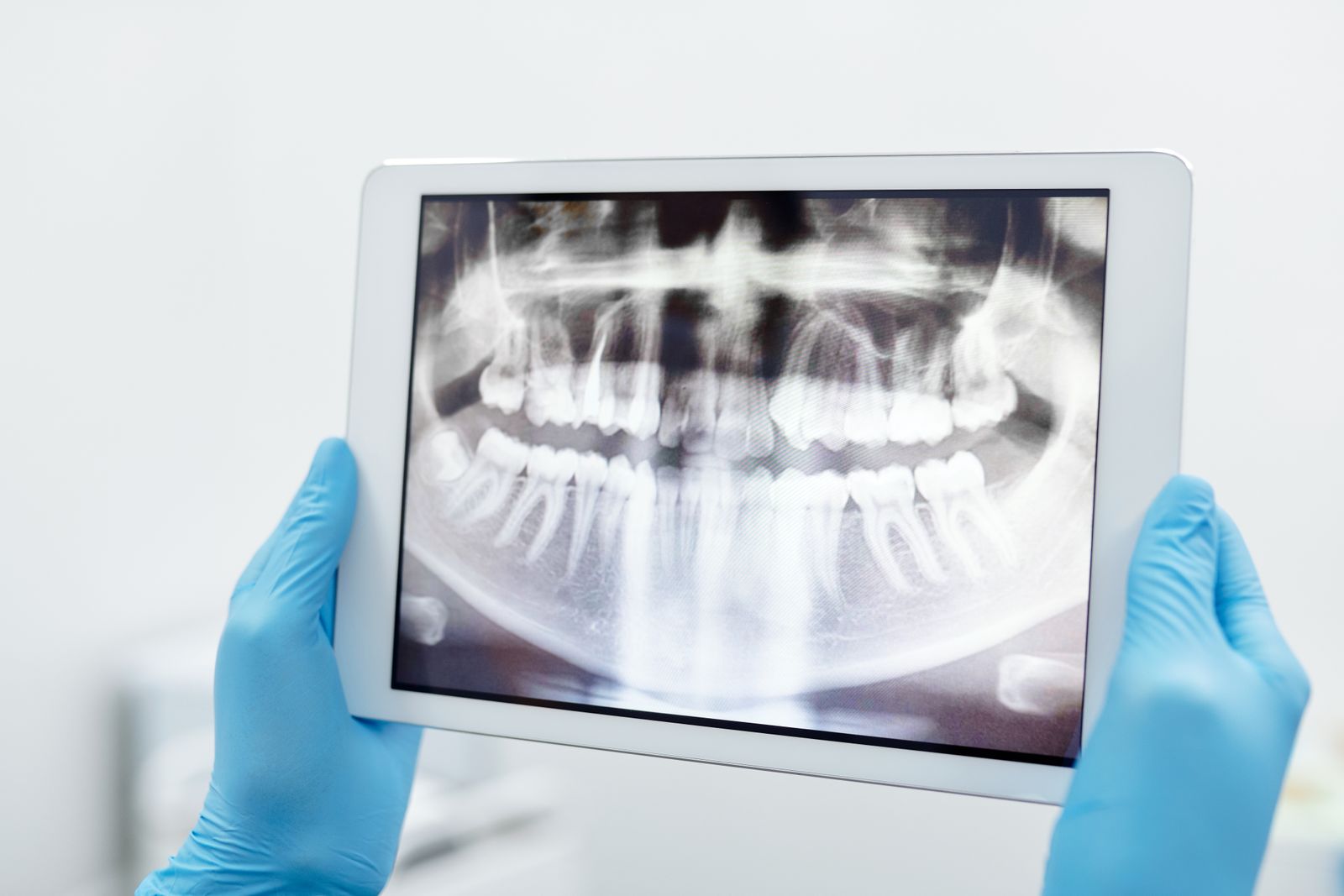 Gloved hands holding a tablet showing a full-mouth dental X-ray