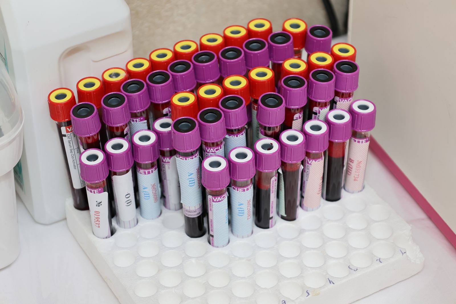 Blood sample tubes with purple and red caps in a white rack